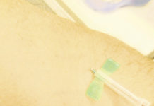 Ritardi e inciampi all’inizio della campagna di vaccinazione